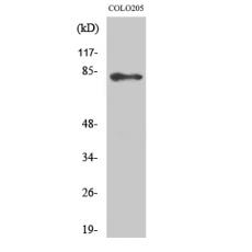 Anti-ABCB10 antibody