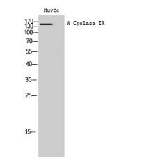 Anti-A Cyclase IX antibody