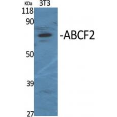 Anti-ABCF2 antibody