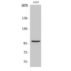 Anti-AAK1 antibody