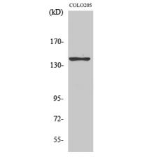 Anti-A Cyclase V/VI antibody