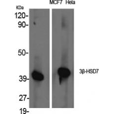 Anti-3β-HSD7 antibody