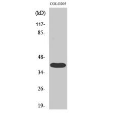 Anti-3pK antibody