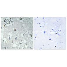 Anti-14-3-3 η antibody