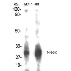 Anti-14-3-3 ζ antibody