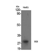 Anti-9G8 antibody