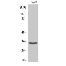 Anti-ANT3 antibody