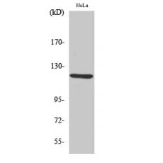 Anti-AOX1 antibody