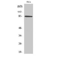 Anti-APC5 antibody