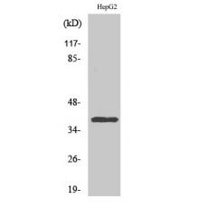 Anti-CCRL2 antibody