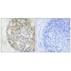 Anti-CD2BP2 antibody