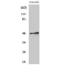 Anti-AP-2α/β antibody