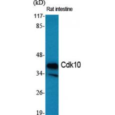 Anti-Cdk10 antibody