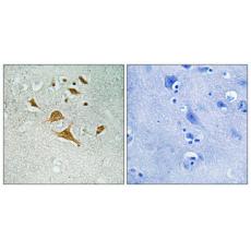 Anti-CDK5 Activator-binding C42 antibody