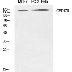 Anti-CEP170 antibody