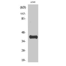 Anti-ApoL1 antibody