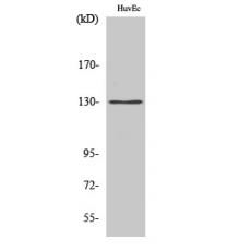Anti-AZI1 antibody