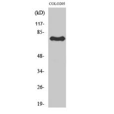 Anti-ATF-6β antibody