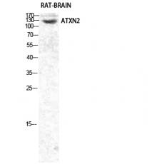 Anti-Ataxin-2 antibody