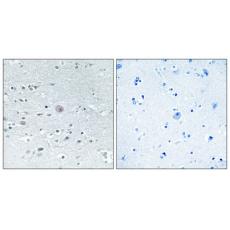 Anti-Arylsulfatase F antibody