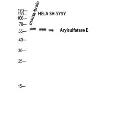 Anti-Arylsulfatase E antibody