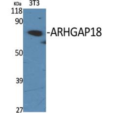Anti-ARHGAP18 antibody