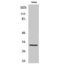 Anti-AQP12 antibody