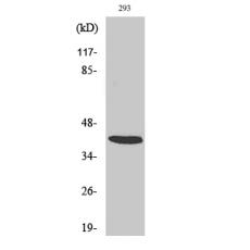 Anti-ARRDC2 antibody