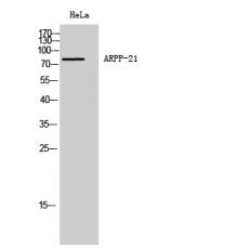 Anti-ARPP-21 antibody