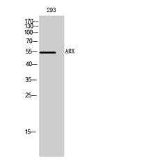 Anti-ARX antibody