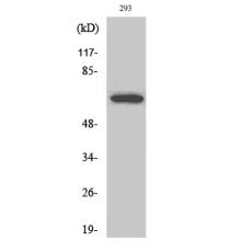 Anti-ARA70 antibody