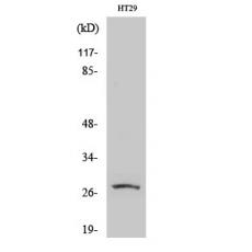 Anti-AQP0 antibody