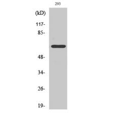 Anti-ARMCX2 antibody