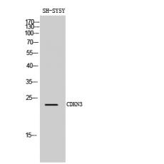Anti-CDKN3 antibody