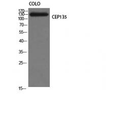 Anti-CEP135 antibody