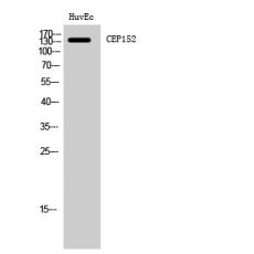 Anti-CEP152 antibody