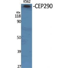 Anti-CEP290 antibody