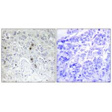 Anti-B-ATF antibody