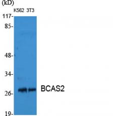 Anti-BCAS2 antibody