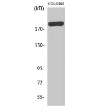 Anti-BCoR antibody