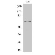 Anti-CEP70 antibody