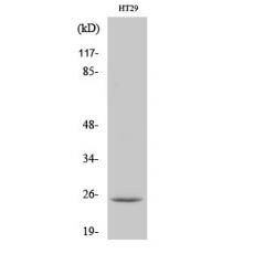 Anti-CIDE-B antibody