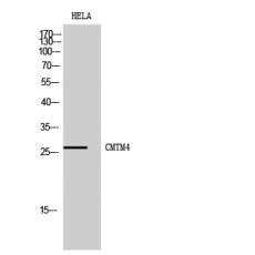 Anti-CMTM4 antibody
