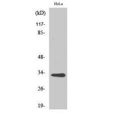 Anti-CNOT7 antibody