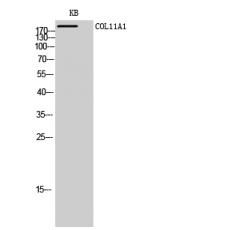 Anti-COL11A1 antibody