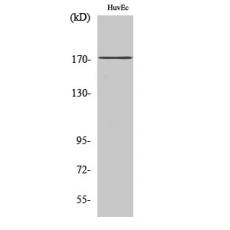 Anti-COL11A2 antibody