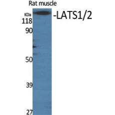 Anti-LATS1/2 antibody