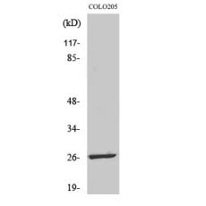 Anti-LDOC1L antibody