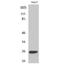 Anti-LT-β antibody