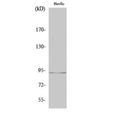 Anti-LUCA15 antibody